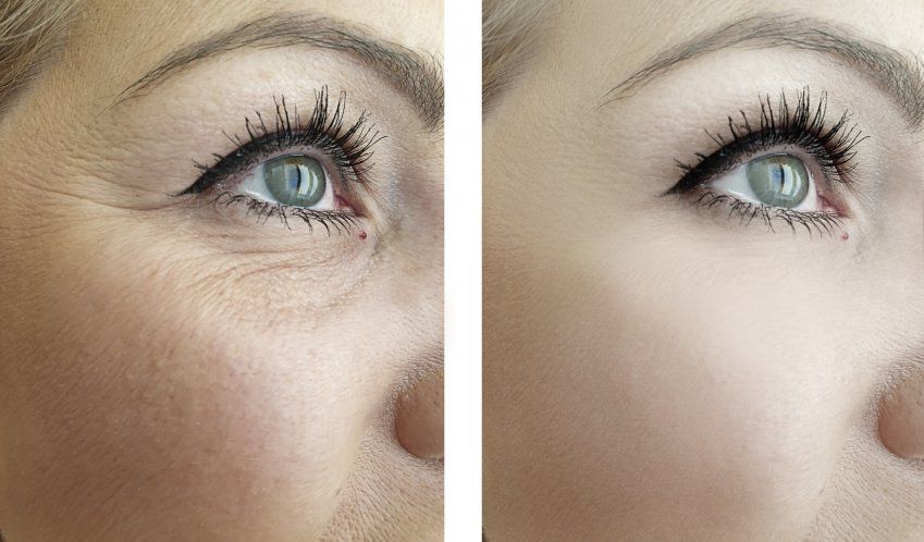 ojos2