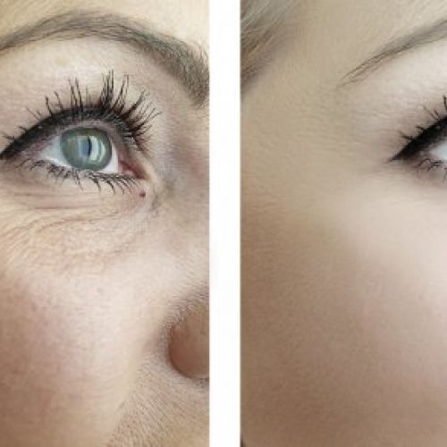 ojos2
